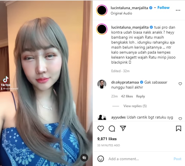 Lucinta Luna Buka Suara Usai Wajah Baru Panen Cibiran: Kalau Udah Kempes Kalian Kaget
