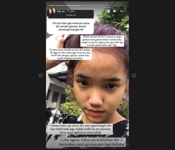 Paras Cantik Kerap Bikin Iri, Fuji Bongkar Pengalaman Saat Insecure Sampai Tak Mau Lakukan Ini