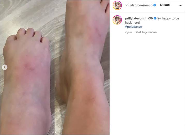 Prilly Latuconsina Bahagia Kembali Tekuni Pole Dance, Penampakan Kondisi Kaki Bikin Ikutan Ngilu
