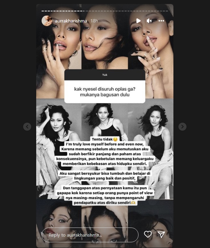 Oplas, Aurra Kharishma Jawab Begini Saat Disebut Lebih Cantik yang Dulu