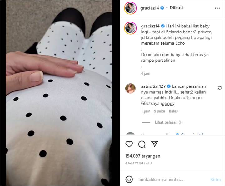 Gracia Indri Ceritakan Pengalaman USG di Belanda, Sebut Tak Bisa Lakukan Ini