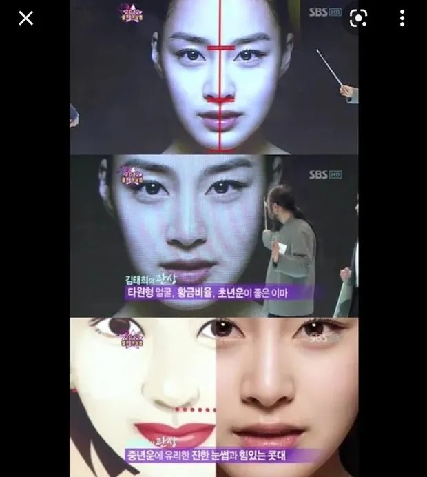 Dokter Oplas Bedah Kesempurnaan Wajah Cantik Kim Tae Hee yang Diinginkan Banyak Wanita