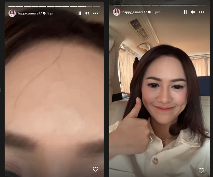 Happy Asmara Ungkap Alasan Mengejutkan yang Bikin Wajahnya Beruntusan Hingga Stres Happy Asmara Ungkap Alasan Mengejutkan yang Bikin Wajahnya Beruntusan Hingga Stres