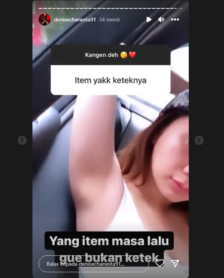 Denise Chariesta Respons Kalem Usai Ketiaknya Disebut Hitam
