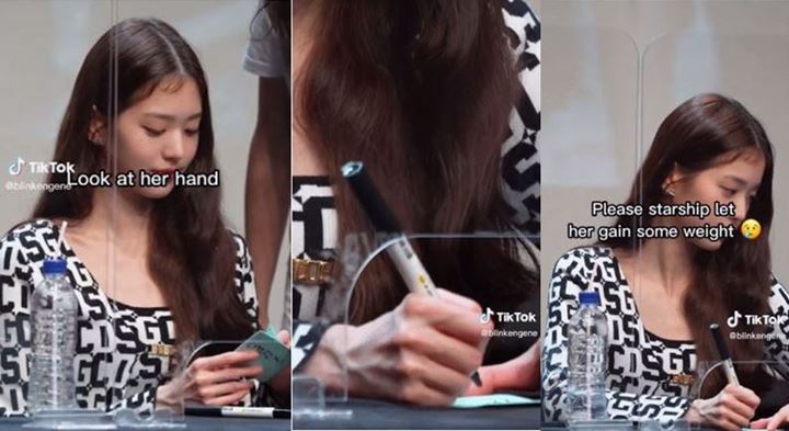 Jang Won Young IVE Lagi-lagi Bikin Khawatir Usai Pembuluh Darah di Tangannya Terlihat Jelas