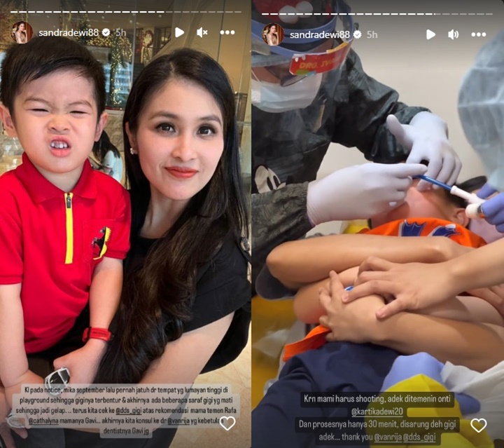 Putra Sandra Dewi Jatuh dari Ketinggian Saat Main di Playground, Bagaimana Kondisinya?