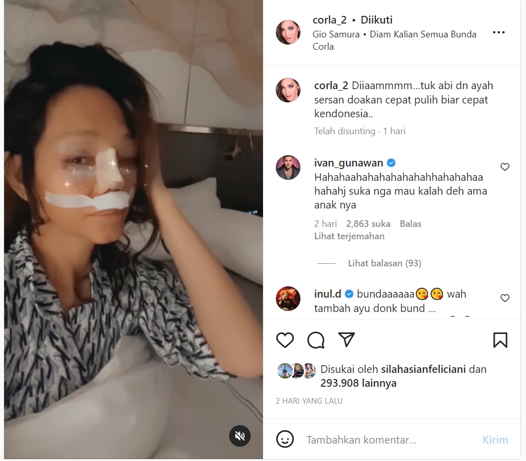 Bunda Corla Tunjukkan Muka Bengkak Banjir Komentar Kecewa