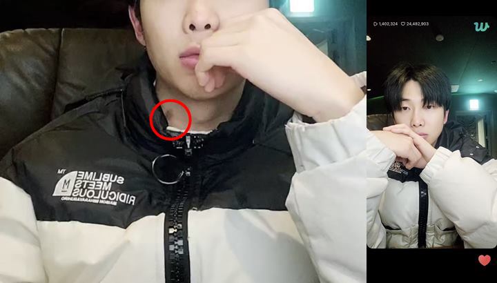 RM BTS Punya Memar di Leher Auto Ramai Dicurigai yang Tidak-Tidak