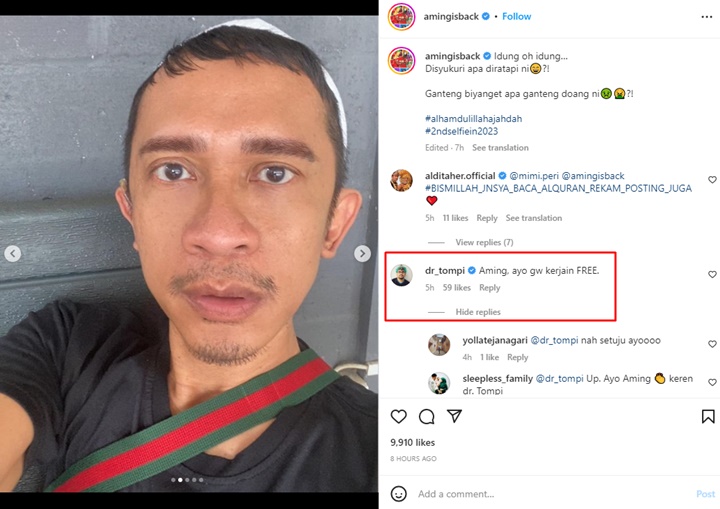 Puji Lucinta Luna, Aming Ditawari Oplas Usai Keluhkan Bentuk Hidungnya