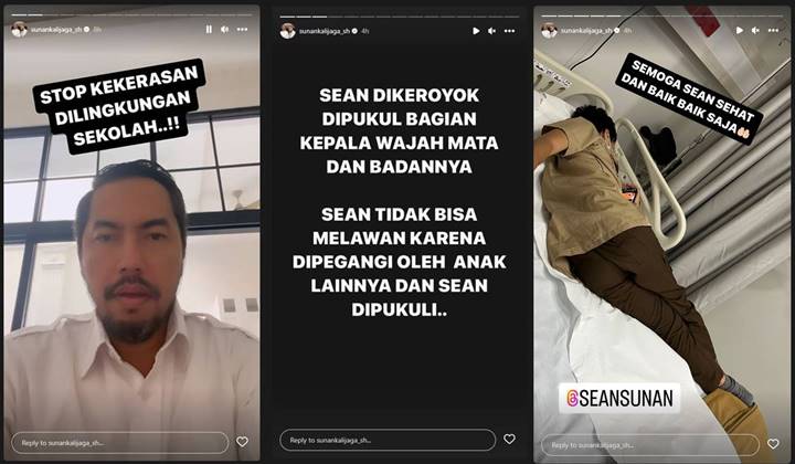 Putra Sunan Kalijaga Alami Lebam di Mata Usai Diduga Dikeroyok di Sekolah