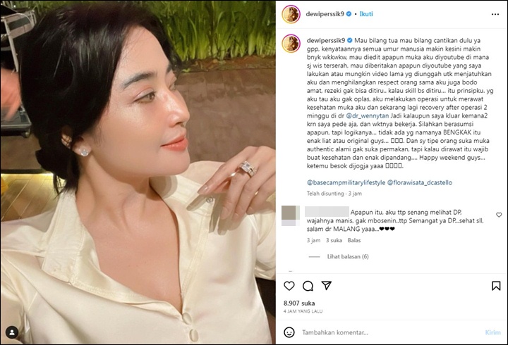 Wajah Disebut Berubah, Dewi Persik Tegaskan Tak Oplas dan Ngaku Suka Muka Alami