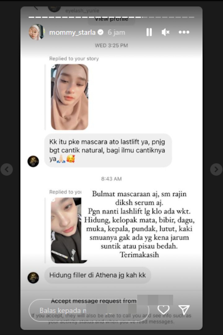 Baru Buka Cadar, Inara Rusli Beri Reaksi Berkelas Usai Dituding Filler Hidung Baru Buka Cadar, Inara Rusli Beri Reaksi Berkelas Usai Dituding Filler Hidung