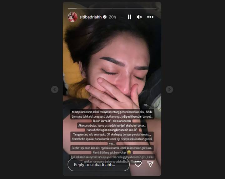 Wajahnya Dikira Kini Berubah, Siti Badriah Bongkar Fakta di Baliknya