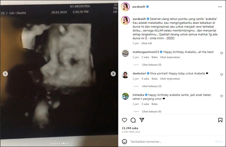 Putri Cantik Aura Kasih Ultah ke-4, Hidung Mancung Sejak di USG Curi Perhatian
