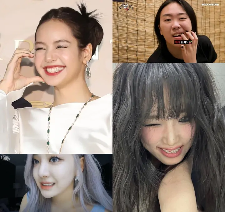 Dari HyunA Sampai Lisa, Permata Gigi Ngetren di Kalangan Selebriti Cewek Dari HyunA Sampai Lisa, Permata Gigi Ngetren di Kalangan Selebriti Cewek