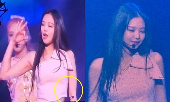 Jennie BLACKPINK Ternyata Sampai Diinfus Jelang Konser \'BORN PINK\' di Osaka