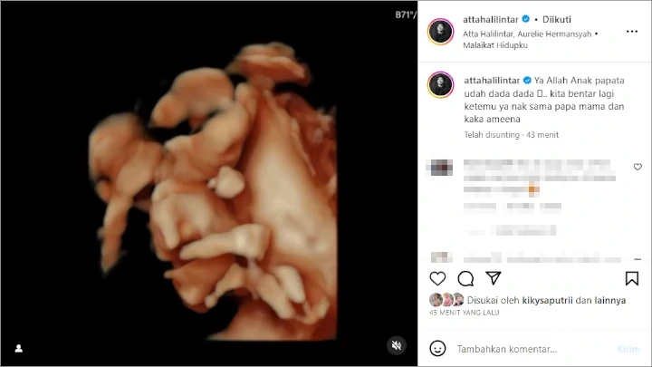 Atta Halilintar Pamer Hasil USG Aurel Hermansyah, Adik Ameena Bak Dadah Dari Dalam Perut Atta Halilintar Pamer Hasil USG Aurel Hermansyah, Adik Ameena Bak Dadah Dari Dalam Perut