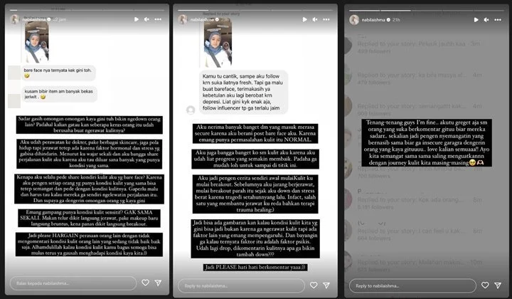 Wajah Bareface Digunjing, Doa Nabila Ishma Menohok