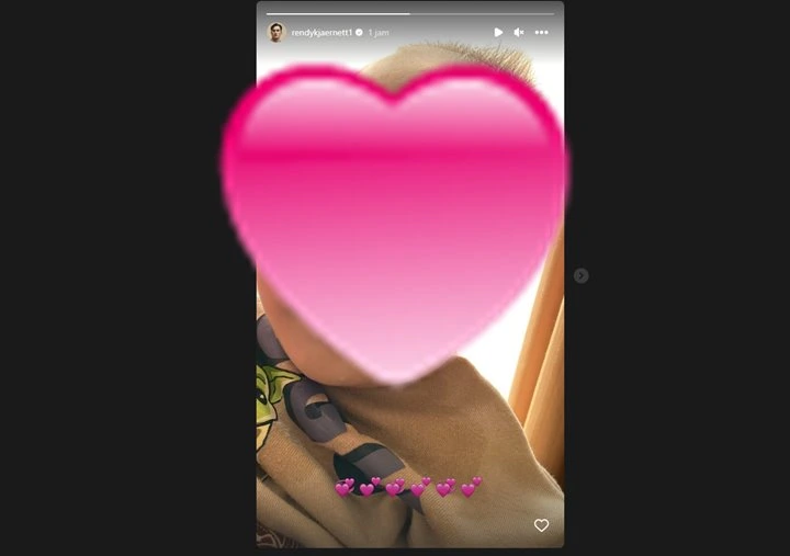 Rendy Kjaernett Posting Foto Usai Dikabarkan Alami Kecelakaan Bareng Lady Nayoan