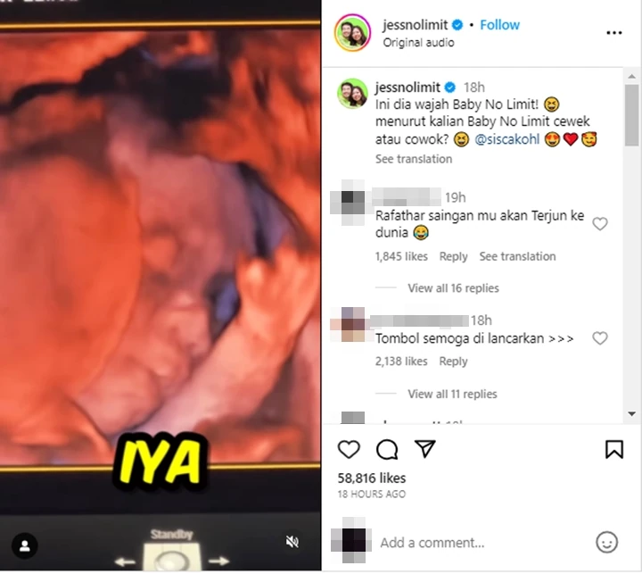 Spill Wajah Anaknya, Jess No Limit Sebut Bisa Jadi Saingan Rayyanza Jess No Limit & Sisca Kohl Spill Wajah Anak, Ramai Digoda Saingan Rayyanza