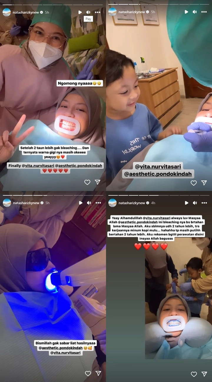 Natasha Rizki Senyum Lebar Pamerkan Gigi Baru Makin Kinclong