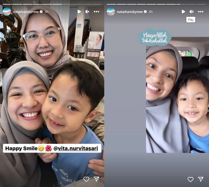 Natasha Rizki Senyum Lebar Pamerkan Gigi Baru Makin Kinclong