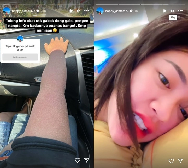  Happy Asmara Ngeluh Badan Panas Sampai Mimisan, Suara Mendadak Ikutan Hilang