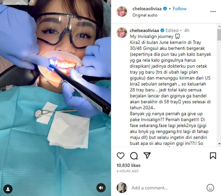 Sedih, Chelsea Olivia Minta Netizen Stop Komentar Soal Gigi Gingsul yang Hilang