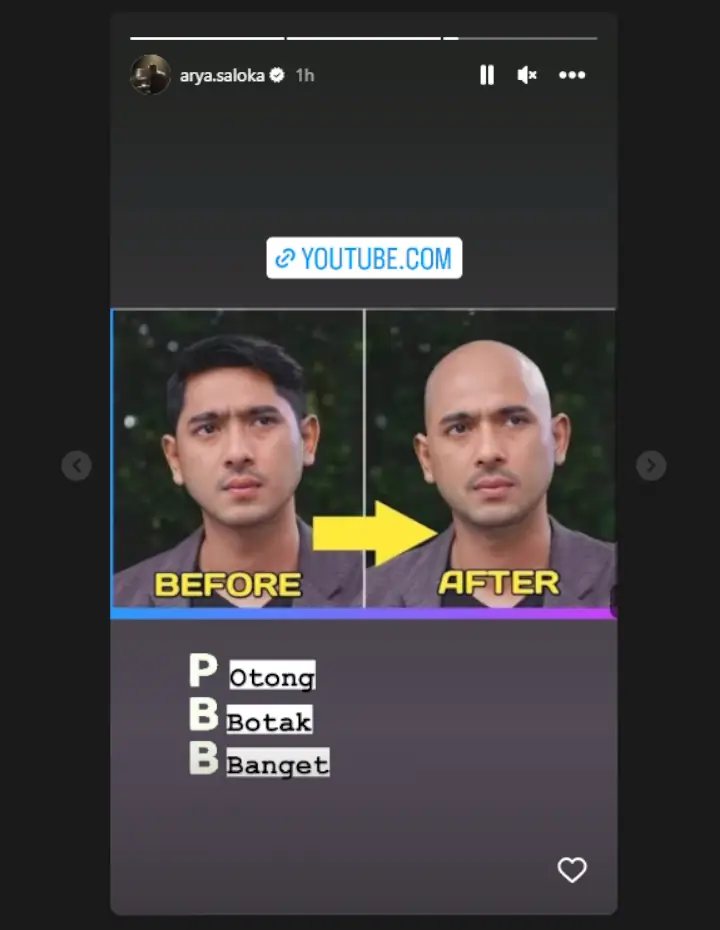 Penampilan Arya Saloka Botak Bikin Syok Penampilan Arya Saloka Botak Bikin Syok Penampilan Arya Saloka Botak Sukses Bikin Syok