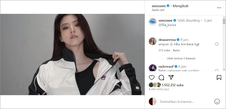 Gebrakan Lagi, Han So Hee Pakai Lip Ring di Konten Baru Justru Bikin Khawatir