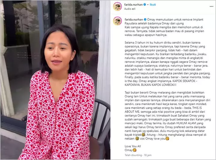 Farida Nurhan \'Omay\' Jalani Operasi Angkat Implan Payudara, Sebut Hukum Diri Sendiri Selama 3 Tahun