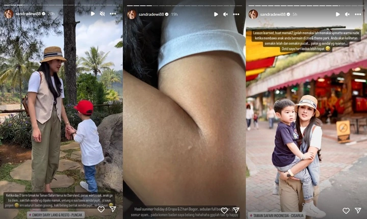 Sandra Dewi Ngereog Gegara Terpapar Matahari, Kulit Putihnya Seketika Gosong