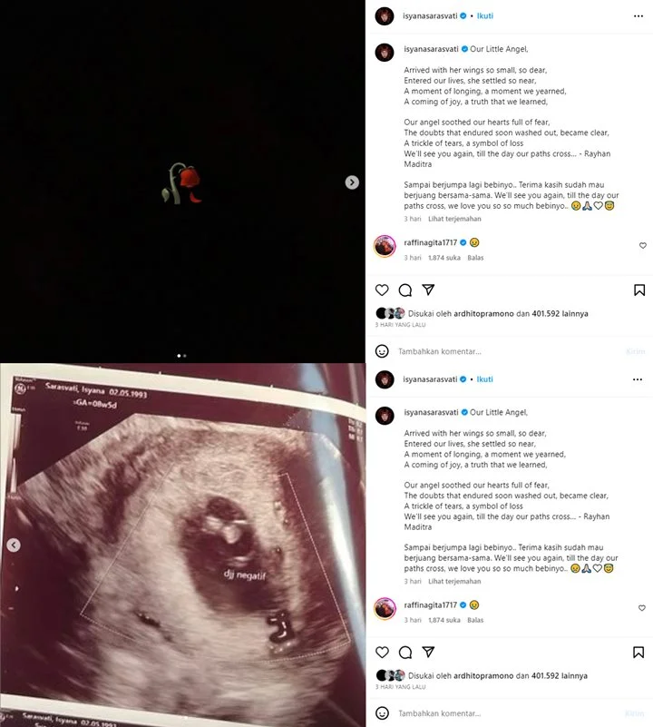 Isyana Sarasvati Alami Keguguran