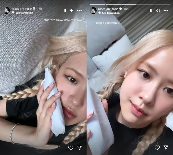 Rose BLACKPINK Pamer Pipi Bengkak Habis Cabut Gigi Bungsu, Hasil Rontgen Bikin Ngeri