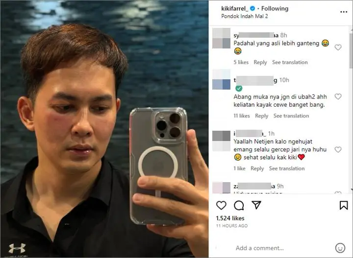 Kiki Farrel Emosi Dituduh Permak Wajah Imbas Foto dengan Pipi Memerah