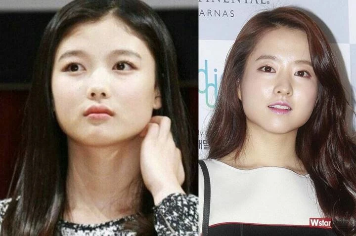 foto lawas Kim Yoo Jung dan Park Bo Young