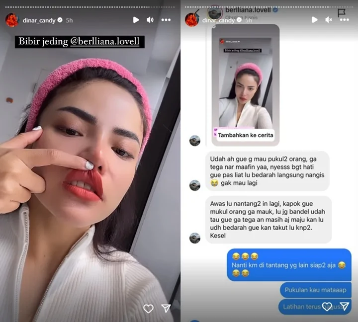 Dinar Candy Ekspos Wajah Berdarah Usai Adu Jotos dengan Rekan Artis