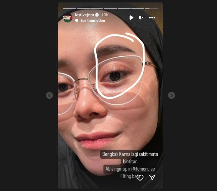 Lesti Kejora Beri Penjelasan Kocak Soal Mata Bengkak di Postingan Terbaru
