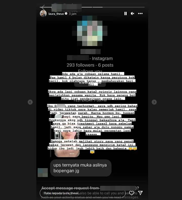Laura Theux Dapat DM Nyinyir Gara-gara Bekas Jerawat di Wajah