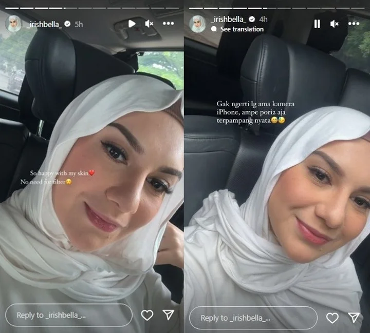 irish Bella Bangga Pamer Wajah Tanpa Filter