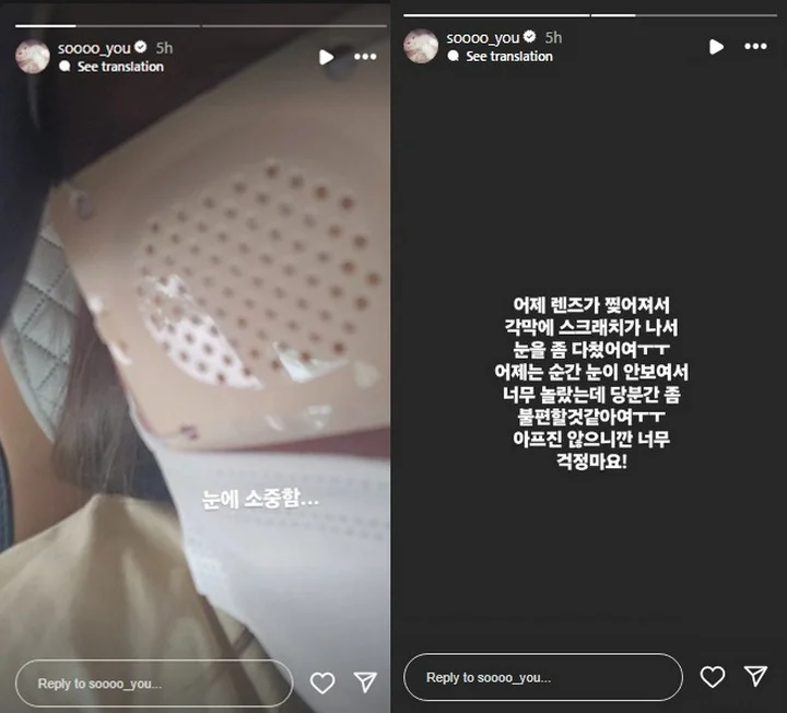 Soyou Eks SISTAR Alami Cedera Kornea Mata Gara-Gara Kontak Lensa