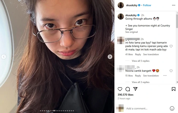 Kondisi Mata Suzy di Postingan Baru Bikin Salfok pasca Diduga Lakukan Operasi