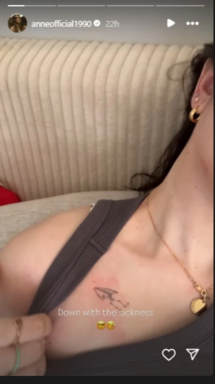IG