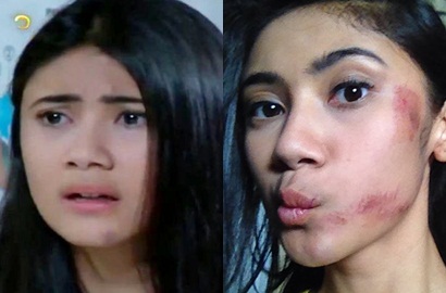 Kecelakaan Syuting 'Manusia Harimau', Wajah Akina Fathia Lebam