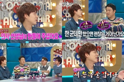 Kyuhyun SuJu Buka-Bukaan Ungkap Bagian Wajahnya yang Dioplas