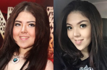 Dagu Semakin Lancip Bikin Tina Toon Diisukan Operasi Plastik