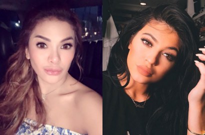 Susul Ariel Tatum dan Aurel Hermansyah, Nikita Mirzani 'Permak' Bibir Seksi Ala Kylie Jenner
