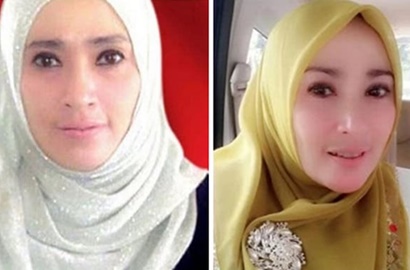 Polisi Hadirkan Ahli Antropometri untuk Periksa Tubuh Firza Husein