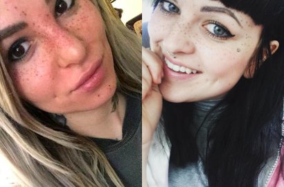 Bintik-Bintik Unik, Tato 'Freckles' Jadi Tren Kecantikan 2017