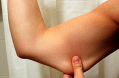Nggak Pede Lemak Menggelambir? Kamu Wajib Coba 12 Masker Alami Biar Bisa Pamer Lengan